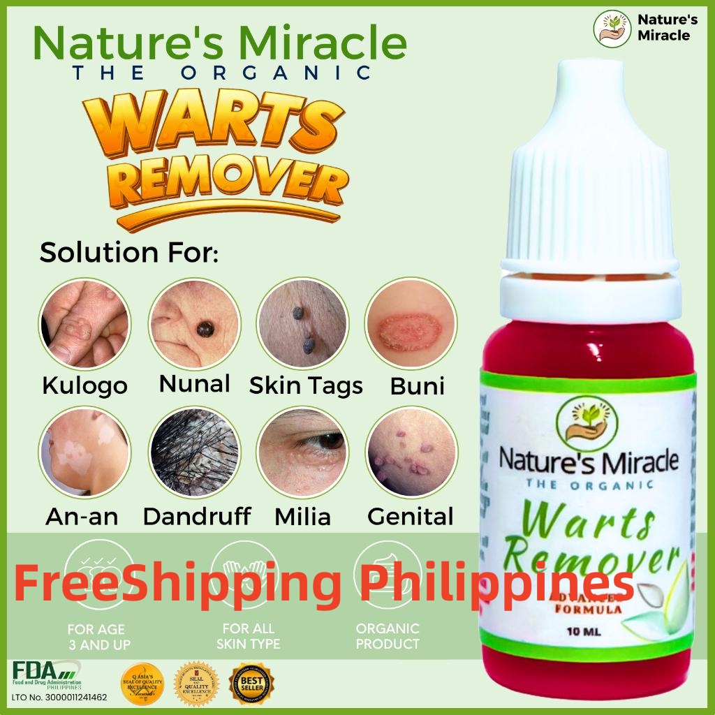 FreeShipping Philippines Warts Remover Kasoy Oil Warts Remover Original Mole Remover Kulogo Buni Removal By Nature