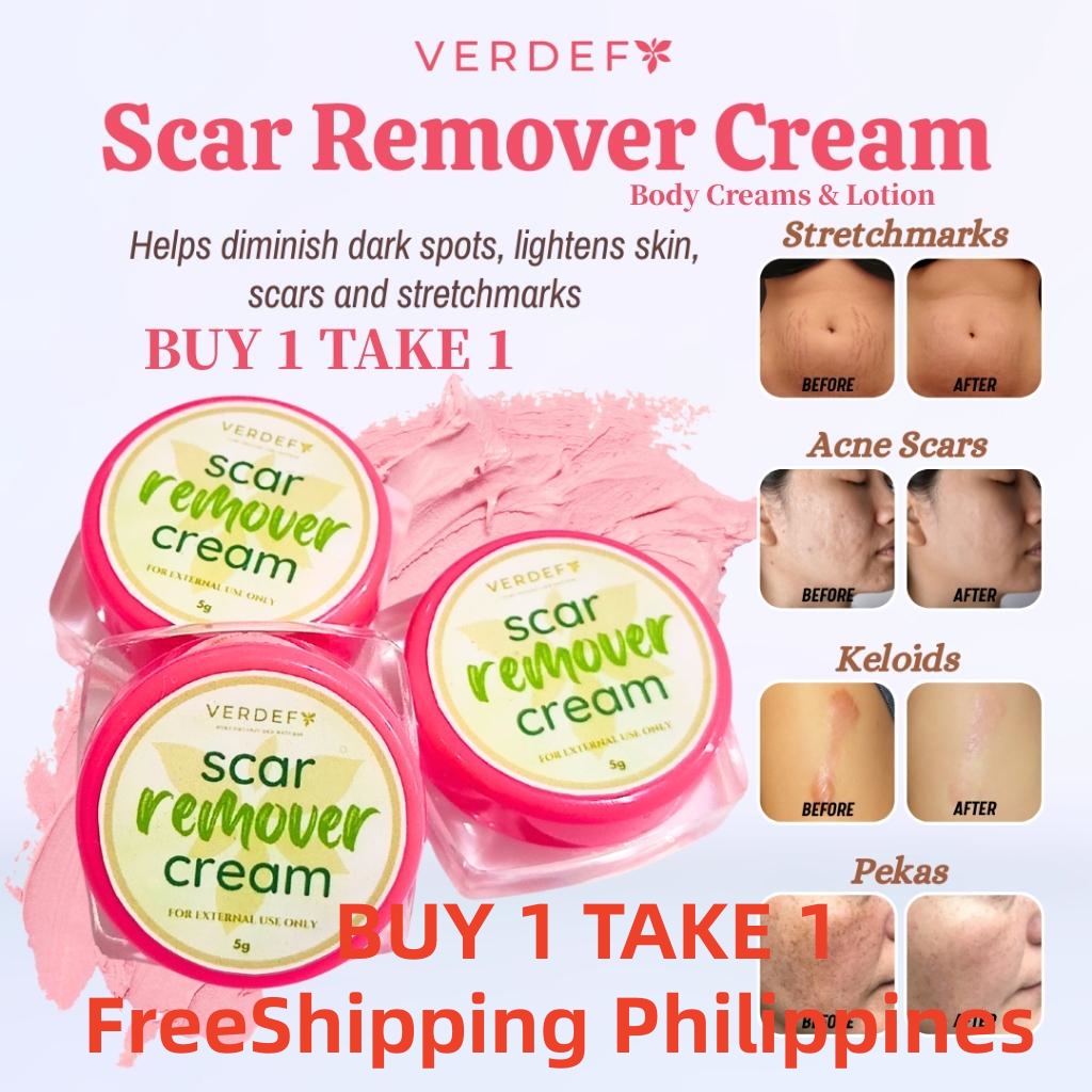 FreeShipping Philippines BUY1 TAKE1 SCAR REMOVER CREAM SKIN CARE REMOVE YOUR OLD AND NEW SCARS Acne Scars Treatment
