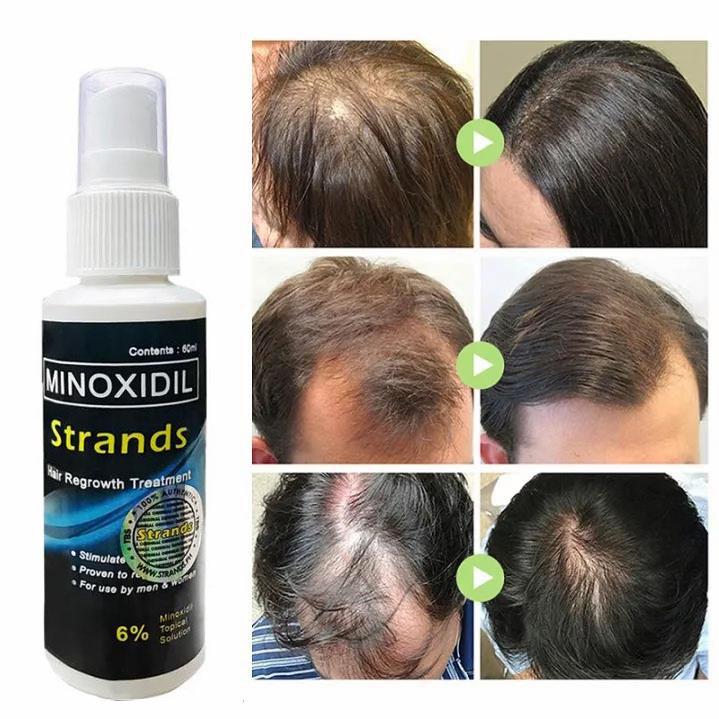 FreeShipping BUY 1 TAKE 1 Strands 6% Minoxidil Hair Grower Original 60ml Hair beard eyebrow Anti Hair Loss grower