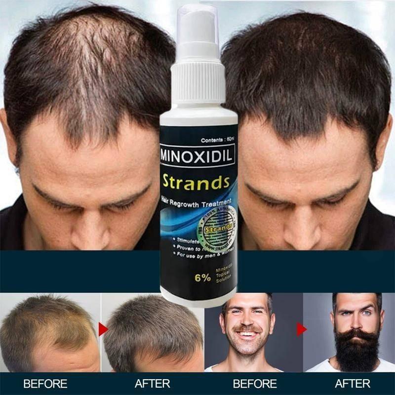 FreeShipping BUY 1 TAKE 1 Strands 6% Minoxidil Hair Grower Original 60ml Hair beard eyebrow Anti Hair Loss grower