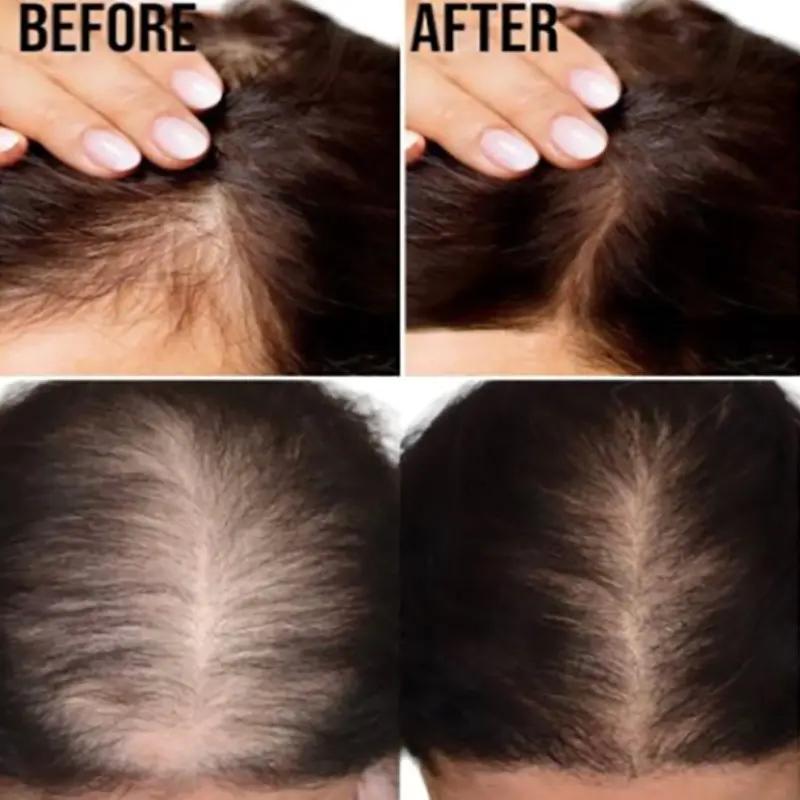 FreeShipping BUY 1 TAKE 1 HOSOKU MINOXIDIL HAIR GROWTH SERUMWITH COLLAGEN AND CASTOR OIL 30ml hair  products Haircare