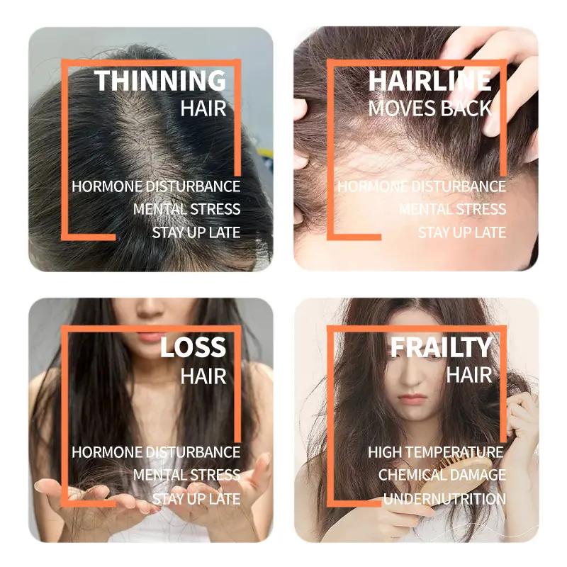FreeShipping BUY 1 TAKE 1 HOSOKU MINOXIDIL HAIR GROWTH SERUMWITH COLLAGEN AND CASTOR OIL 30ml hair  products Haircare