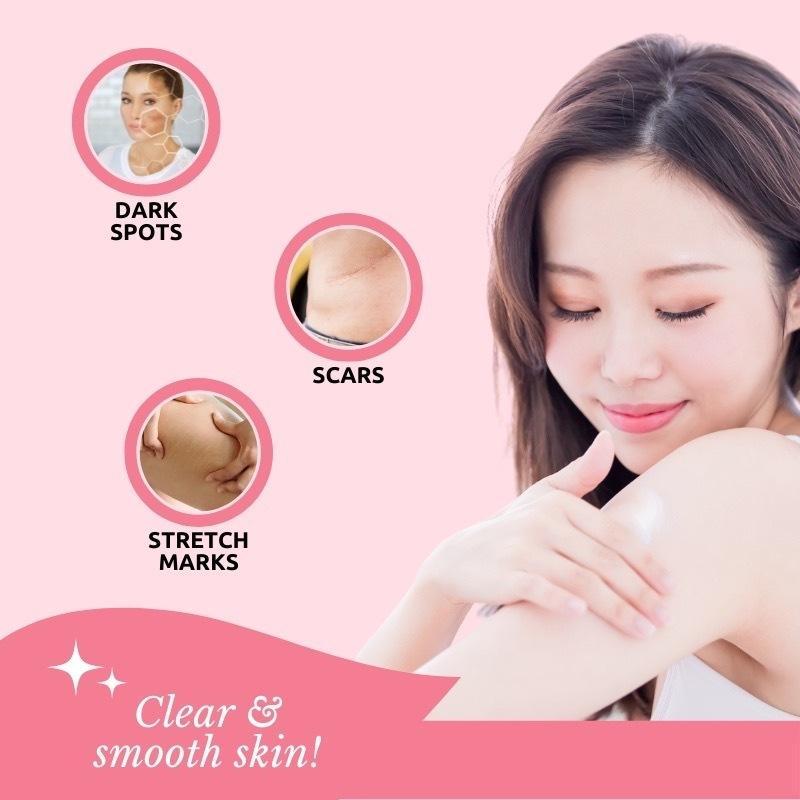 FreeShipping( BUY 1 TAKE 2 ) SCD Peeling Skin Lotion for Scars Dark Spots and Stretch Marks! Promotes Skin Whitening