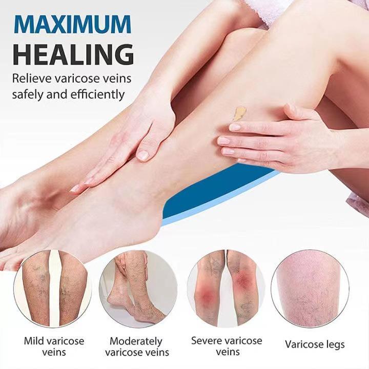 FreeShipping『BUY 2 TAKE 1』Varicose Veins Cream Soothing Leg Cream Natural Herbal Plaster for Tired and Heavy Legs Fast Relief Strengthen Capillary Health Improve Blood Circulation