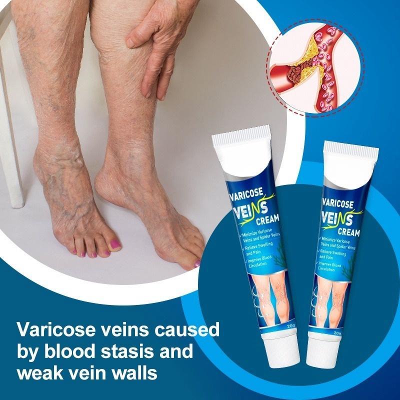 FreeShipping『BUY 2 TAKE 1』Varicose Veins Cream Soothing Leg Cream Natural Herbal Plaster for Tired and Heavy Legs Fast Relief Strengthen Capillary Health Improve Blood Circulation